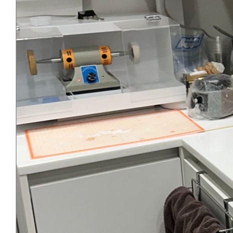 매복사랑니발치후기 읽고 걱정하셨다면 관련 이미지 6