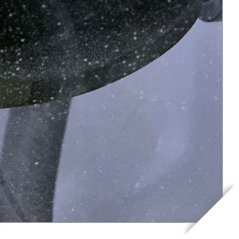 송정동임플란트 편안한 회복을 위해 관련 이미지 12