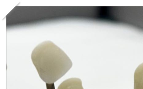 한강로동임플란트 앞니부터 어금니까지 꼼꼼하게 관련 이미지 4