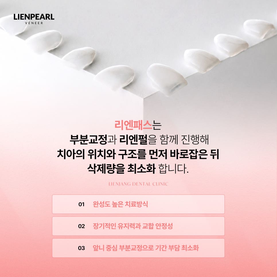 라미네이트 교정 고민될 때, 리엔패스로 살펴봐야 할 것! 관련 이미지 3