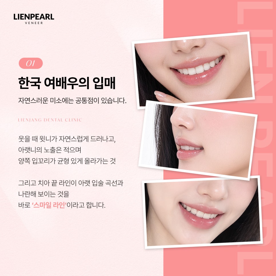 40대부터의 한국식 구강, 리엔장치과 최종명 대표원장이 오사카에서 전하다! 관련 이미지 4
