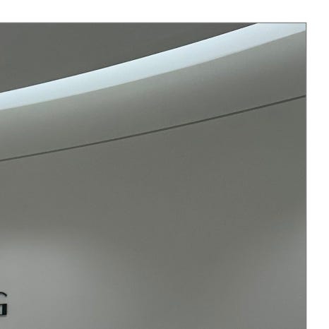 치과레진 치료의 장단점 관련 이미지 5