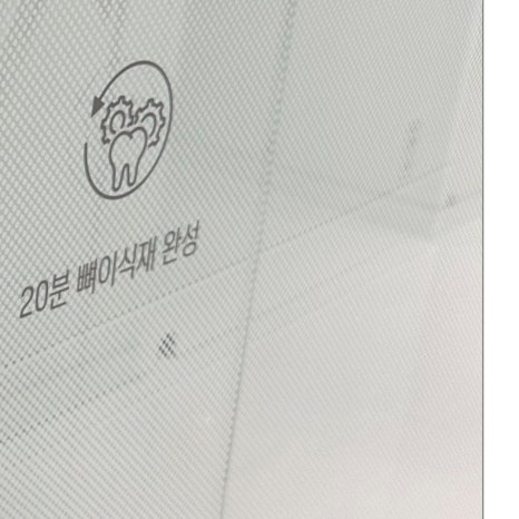 구로동라미네이트 아름다운 미소를 위한 선택 관련 이미지 9