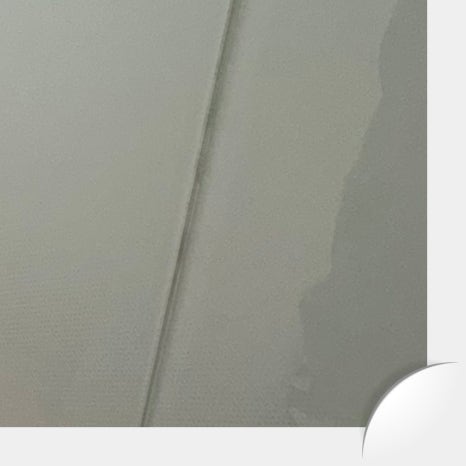 역삼임플란트 식립 과정까지 고려해야 관련 이미지 21