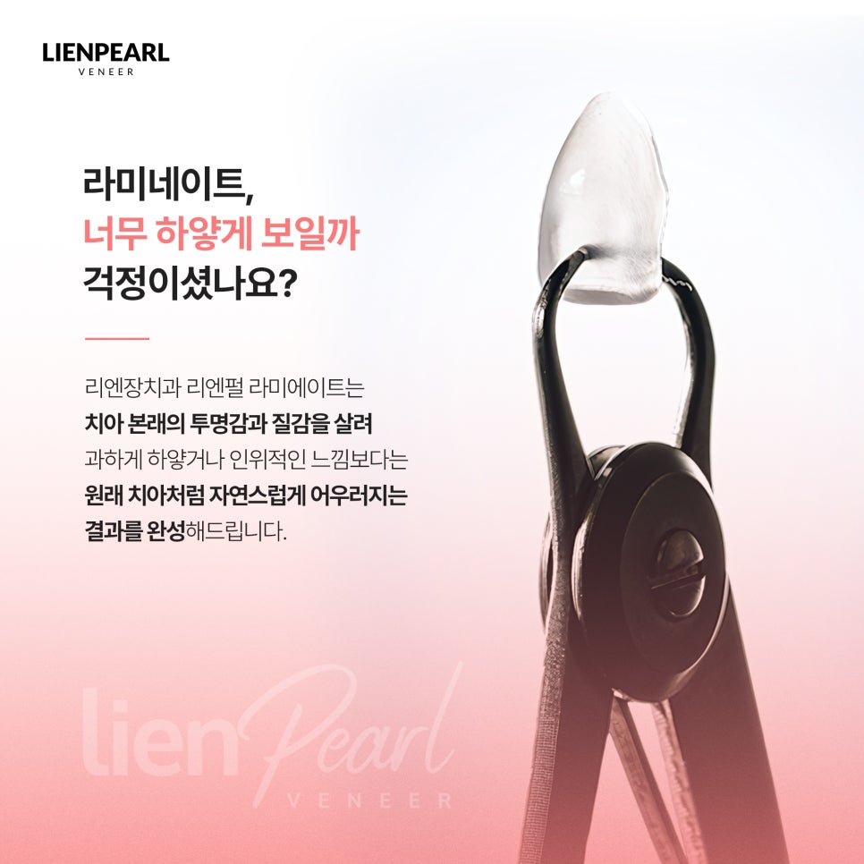 강남 라미네이트 잘하는 곳을 찾고 있다면? 자연스러운 미소를 위한 포인트 체크! 관련 이미지 2