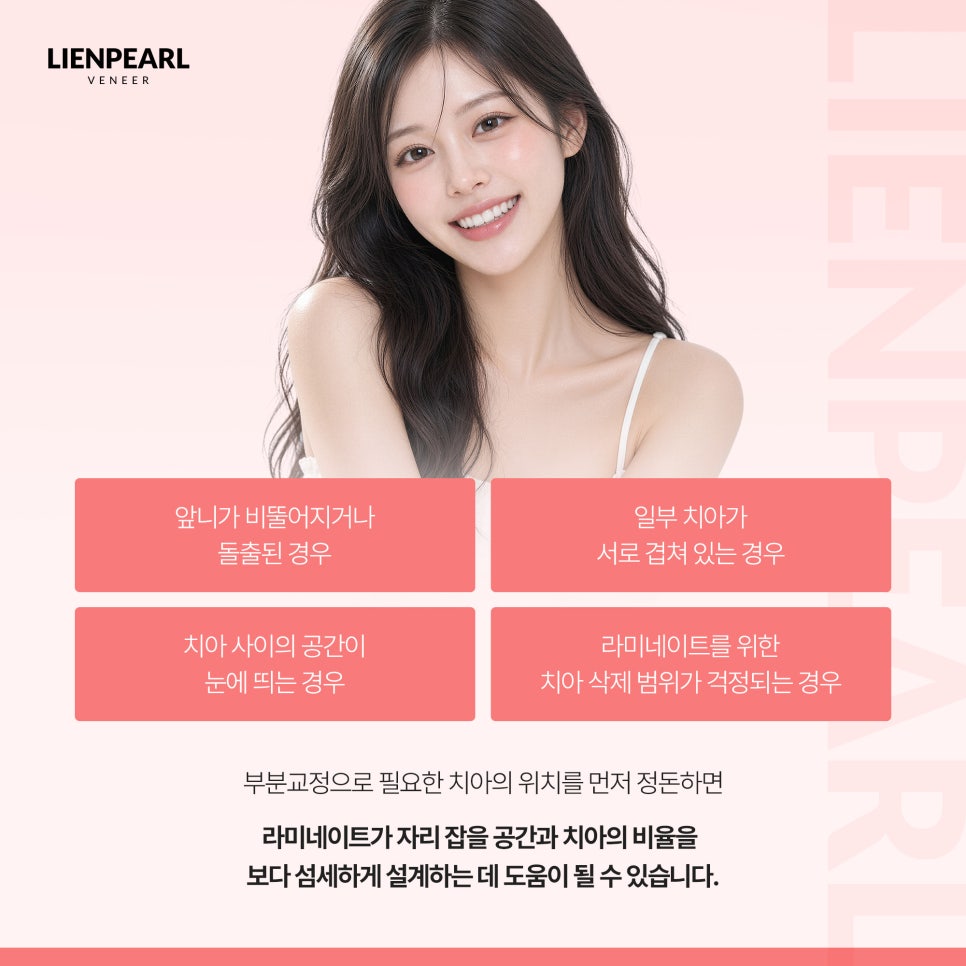 라미네이트 시술 과정은 어떻게 진행될까? 리엔패스로 확인하세요! 관련 이미지 3