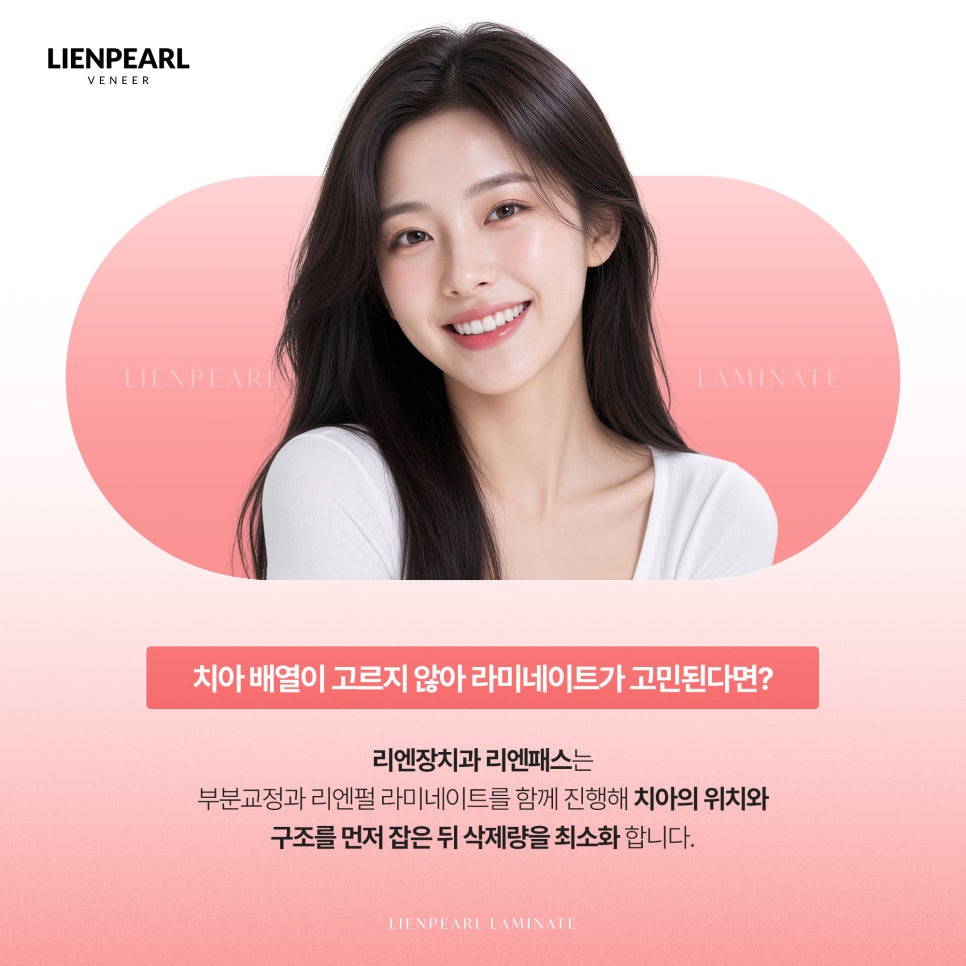 라미네이트 수명, 오래 유지하려면 무엇이 중요할까요? 관련 이미지 6