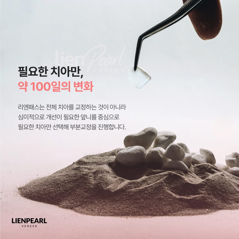 앞니 라미네이트 비용 고민된다면? 함께 확인해야 할 기준 관련 이미지 4