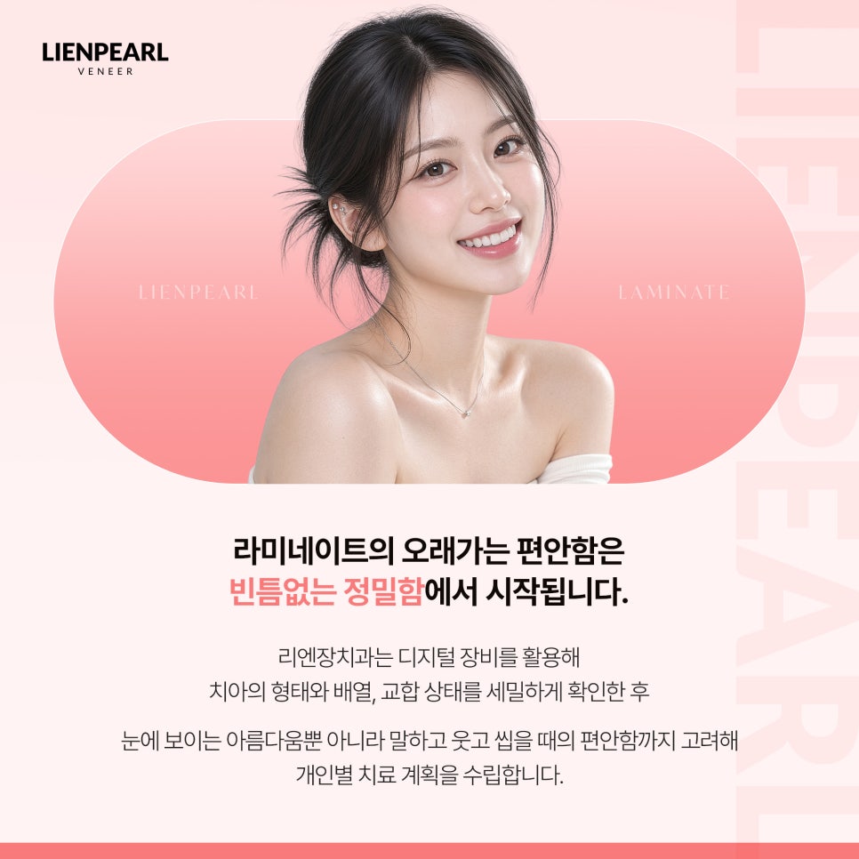 라미네이트 유지기간이 궁금하다면? 관련 이미지 3