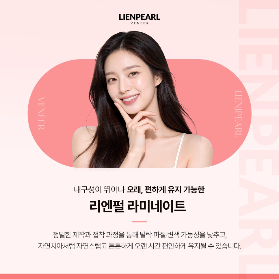 라미네이트 치과 알아볼 때 필수 체크사항은? 관련 이미지 4