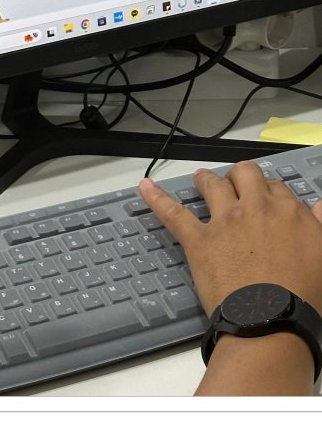 장충동임플란트 주위염 예방하고 건강하게 관련 이미지 20