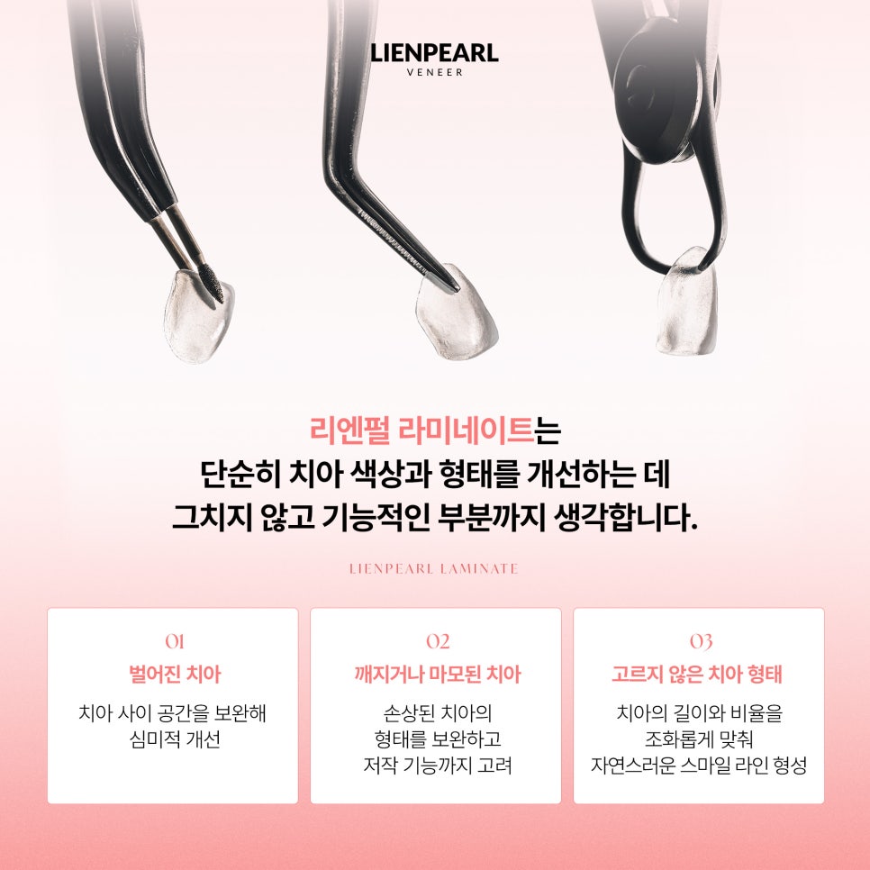 라미네이트 치아 미백, 내 얼굴에 어울리는 밝기를 찾는 법! 관련 이미지 6