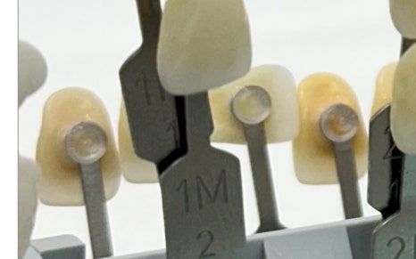 한강로동임플란트 앞니부터 어금니까지 꼼꼼하게 관련 이미지 7