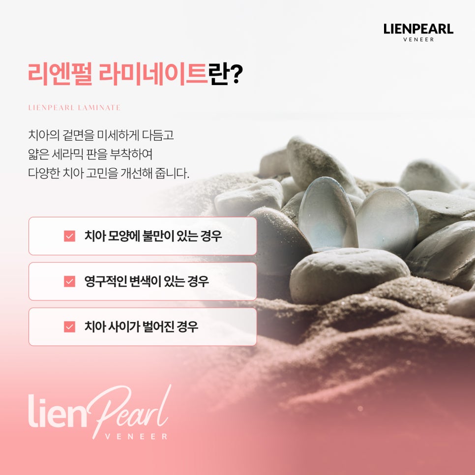 강남역 라미네이트, 제대로 알아보고 싶다면? 관련 이미지 2