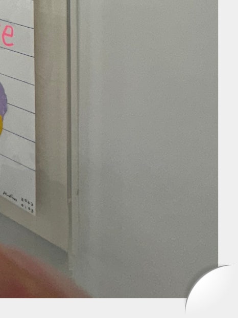 창동임플란트 신중히 결정해야 하는 이유 관련 이미지 30
