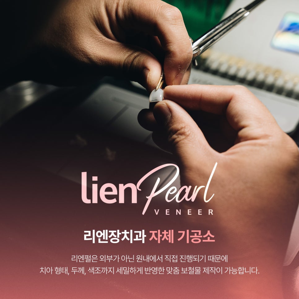 앞니 라미네이트 가격, 제작 기간이 궁금하다면? 관련 이미지 5