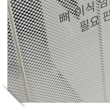 구로동라미네이트 아름다운 미소를 위한 선택 관련 이미지 10