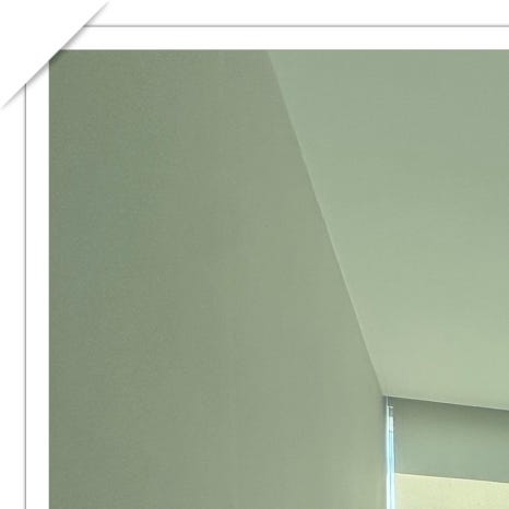 역삼임플란트 식립 과정까지 고려해야 관련 이미지 4