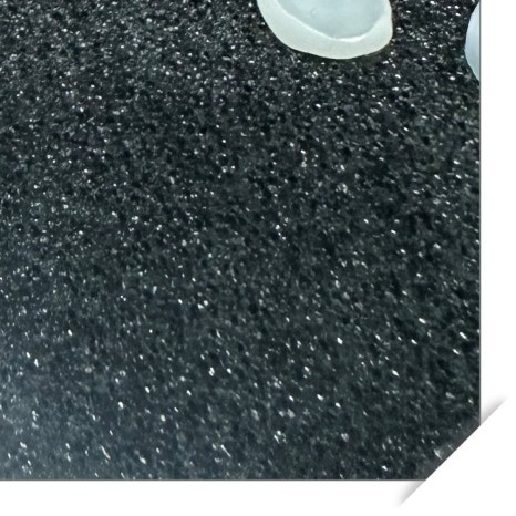 치과보철물 종류별 가격과 특징 관련 이미지 11