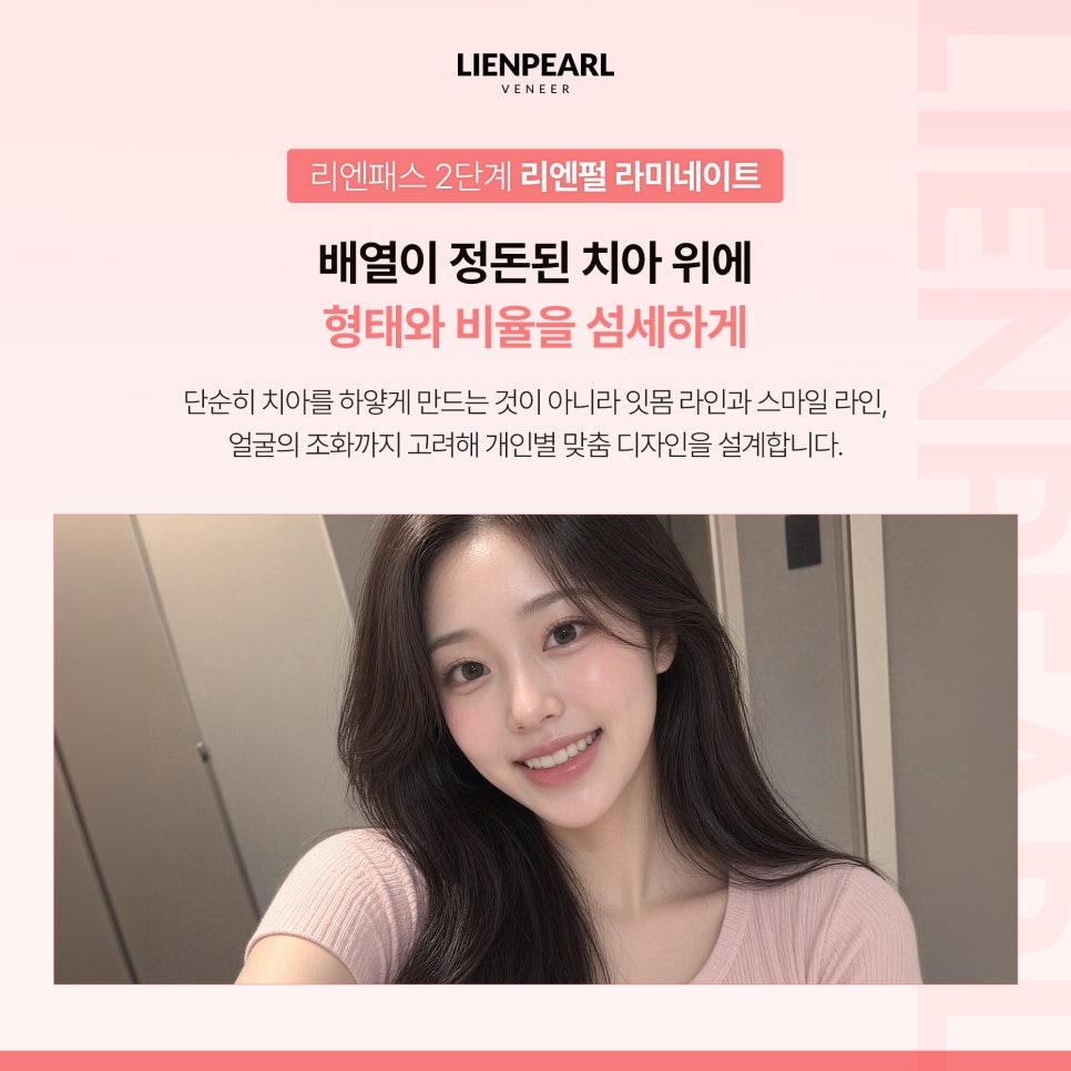 라미네이트 기간, 교정이 필요한 경우 얼마나 걸릴까? 관련 이미지 5
