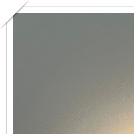 용산동임플란트 나에게 맞는 과정으로 관련 이미지 4