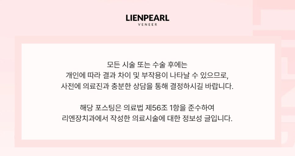 라미네이트 기간, 교정이 필요한 경우 얼마나 걸릴까? 관련 이미지 11
