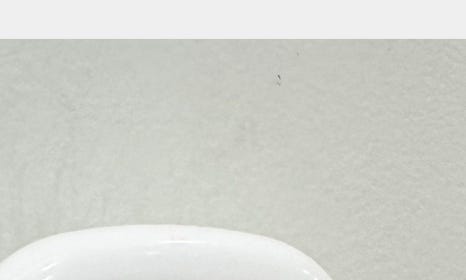 개포임플란트 맞춤형으로 튼튼하게 관련 이미지 35