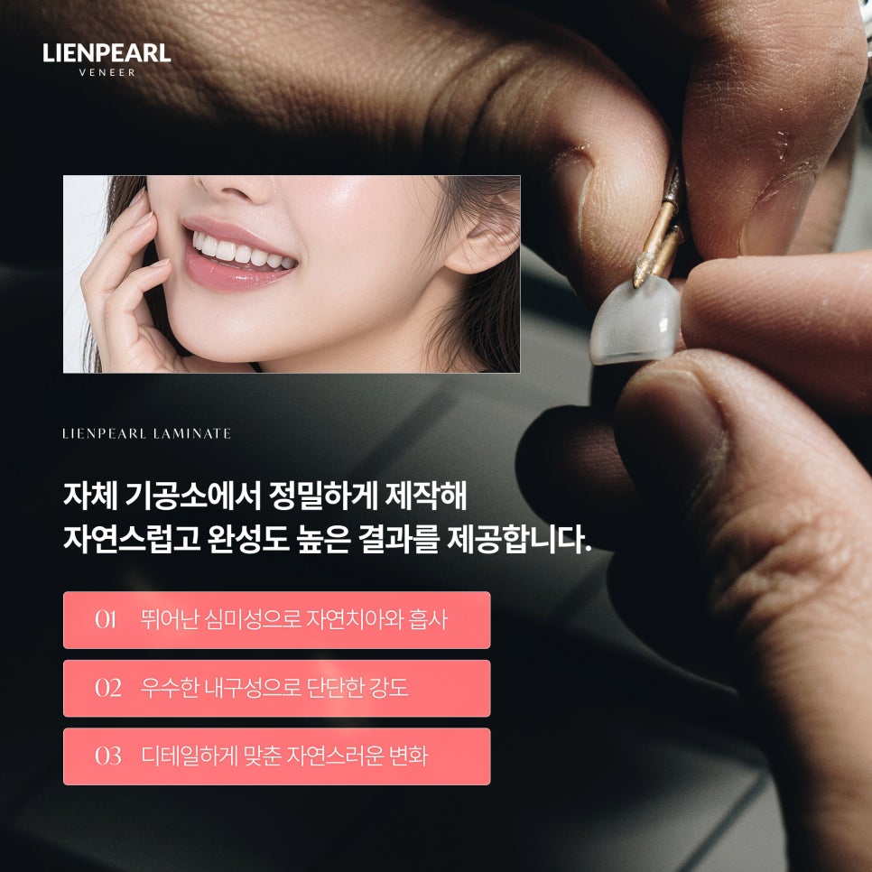 내 얼굴에 맞는 라미네이트 방법, 리엔장치과 리엔펄! 관련 이미지 5