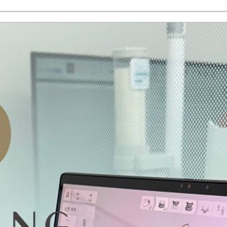 장충동임플란트 주위염 예방하고 건강하게 관련 이미지 5