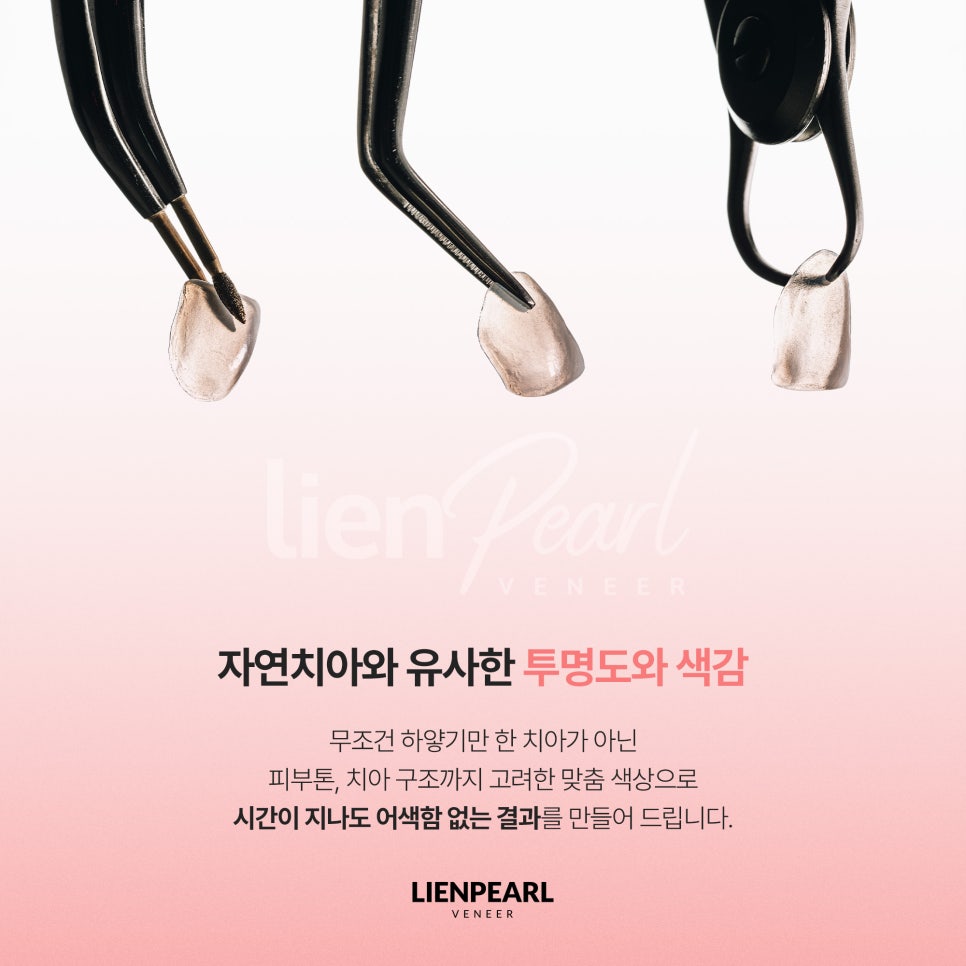 내 얼굴에 맞는 라미네이트 방법, 리엔장치과 리엔펄! 관련 이미지 6