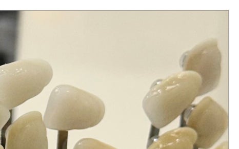 한강로동임플란트 앞니부터 어금니까지 꼼꼼하게 관련 이미지 6