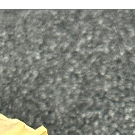 윗니 부분 교정 장단점 정리 관련 이미지 4