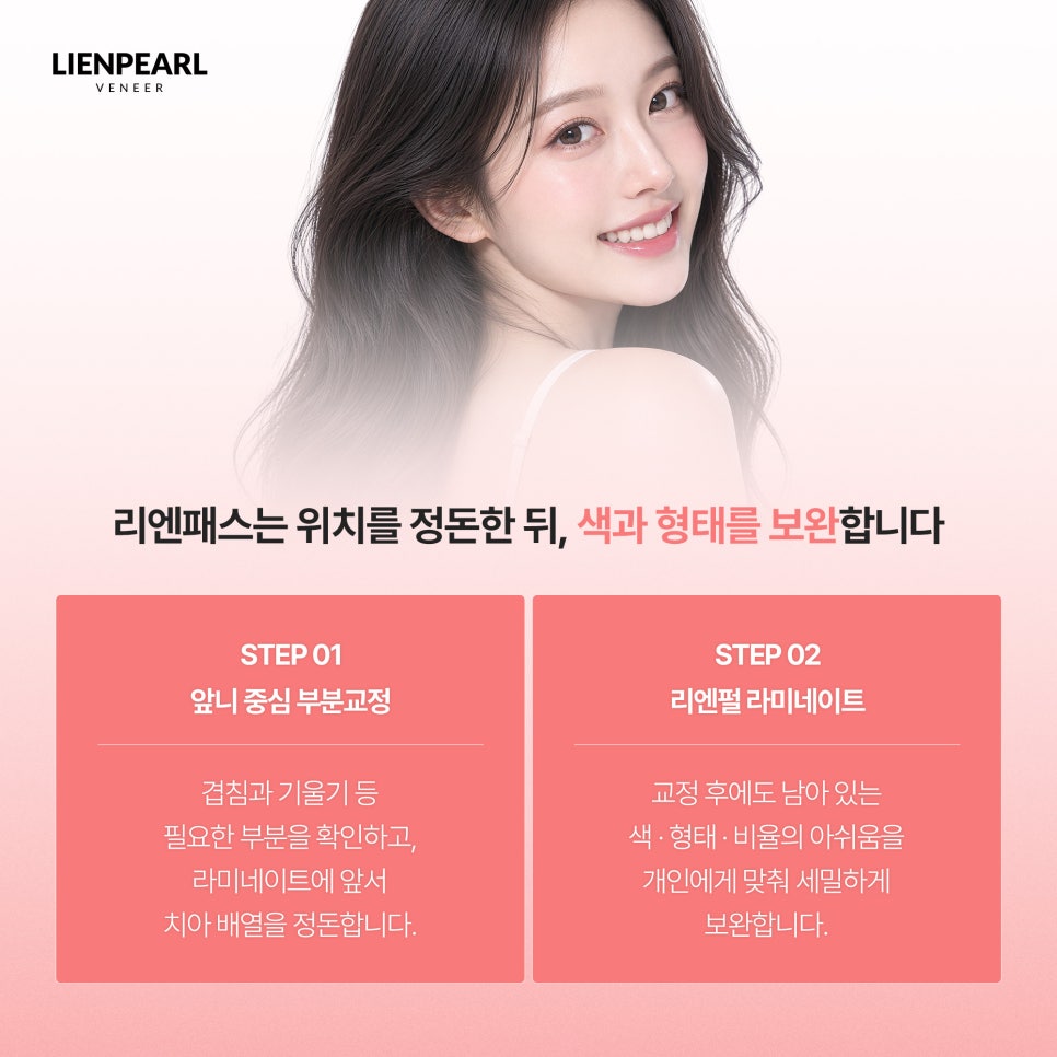 강남구 라미네이트 받기 전에 꼭 확인해야 할 3가지! 관련 이미지 5