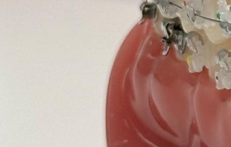 연희임플란트 디지털 네비게이션과 3D 기술로 안전하고 정밀하게 관련 이미지 9