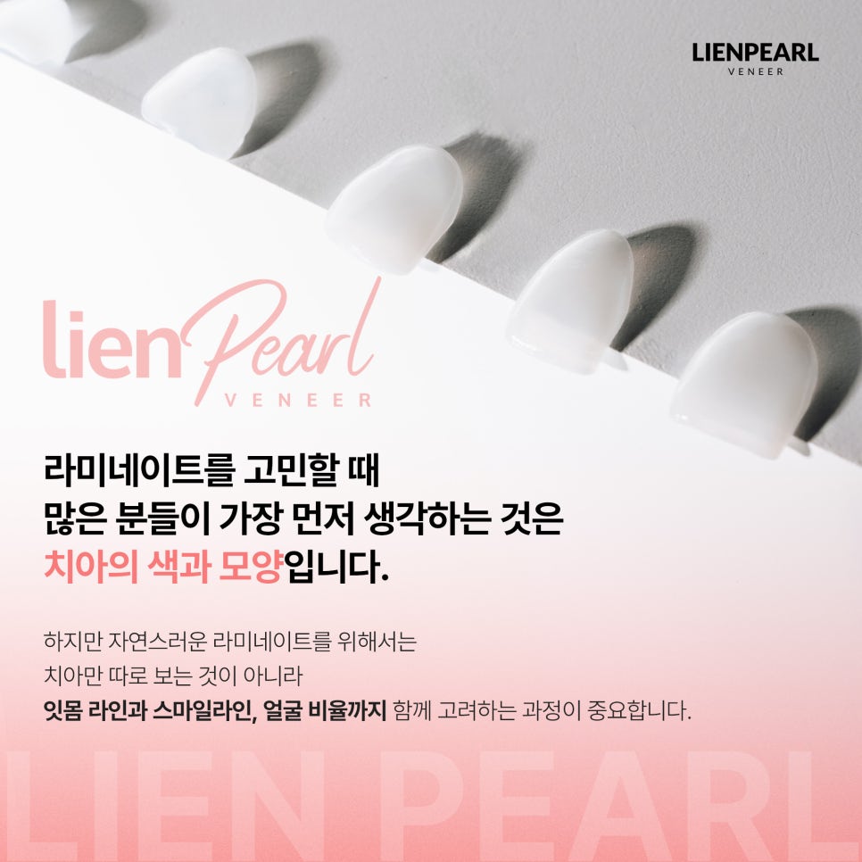 하루 만에 가능할까? 강남 원데이 라미네이트 체크포인트! 관련 이미지 5
