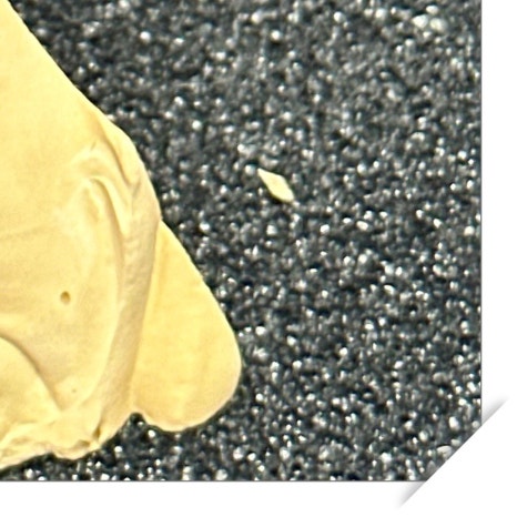 갑자기이빨아플때 원인과 치료 과정 관련 이미지 11