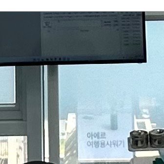 남영동임플란트 비교하기 어려웠다면 관련 이미지 5