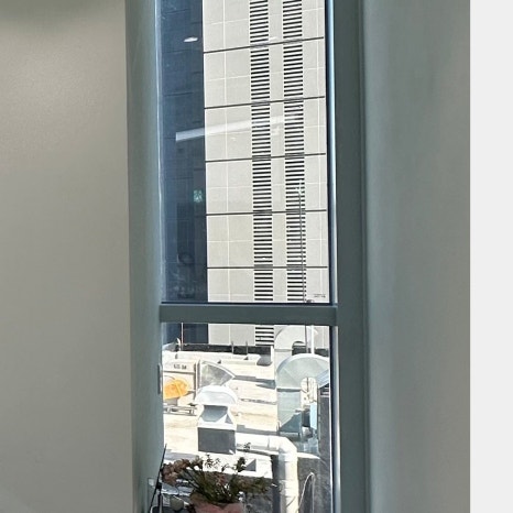 역삼임플란트 식립 과정까지 고려해야 관련 이미지 27