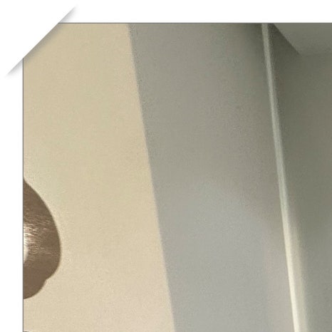 금호동임플란트 편안한 식립을 위해 관련 이미지 4