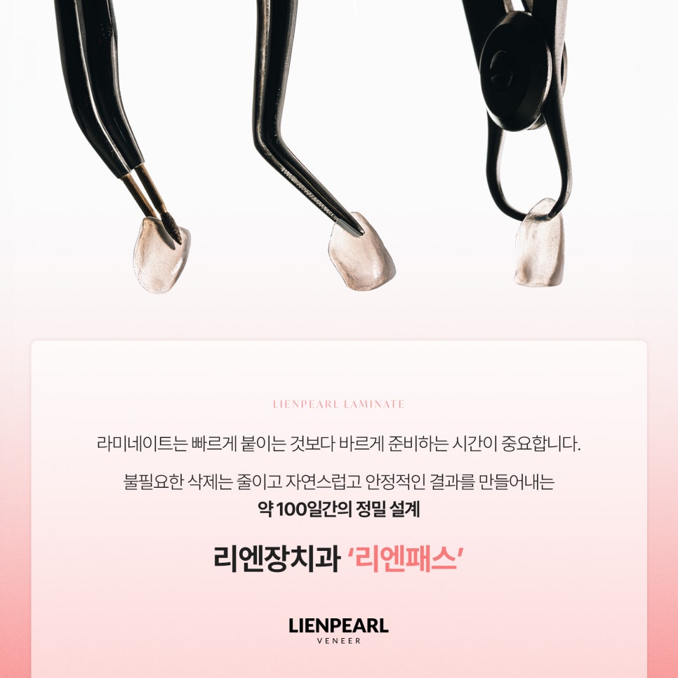 라미네이트 기간, 교정이 필요한 경우 얼마나 걸릴까? 관련 이미지 2