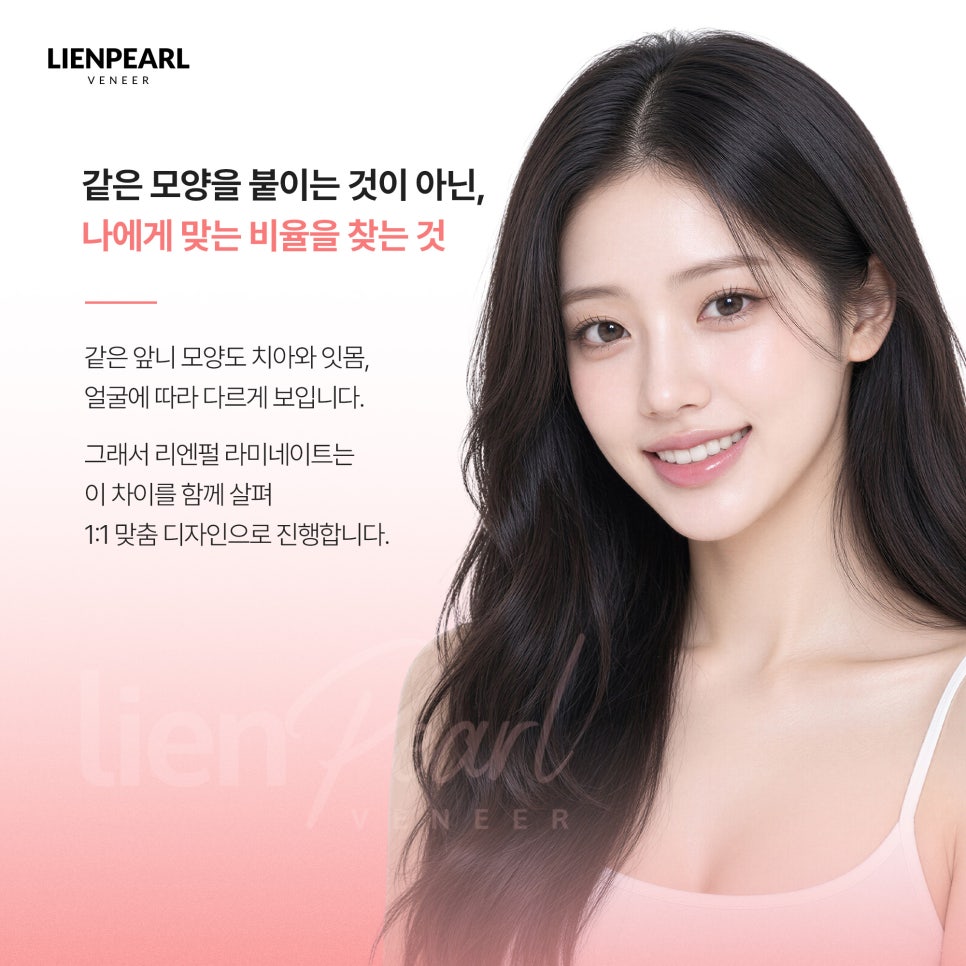 치아 라미네이트 가격이 고민이라면? 상담 전 체크리스트 관련 이미지 3