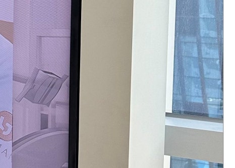 효창동임플란트 뼈 이식까지 생각한다면 관련 이미지 9