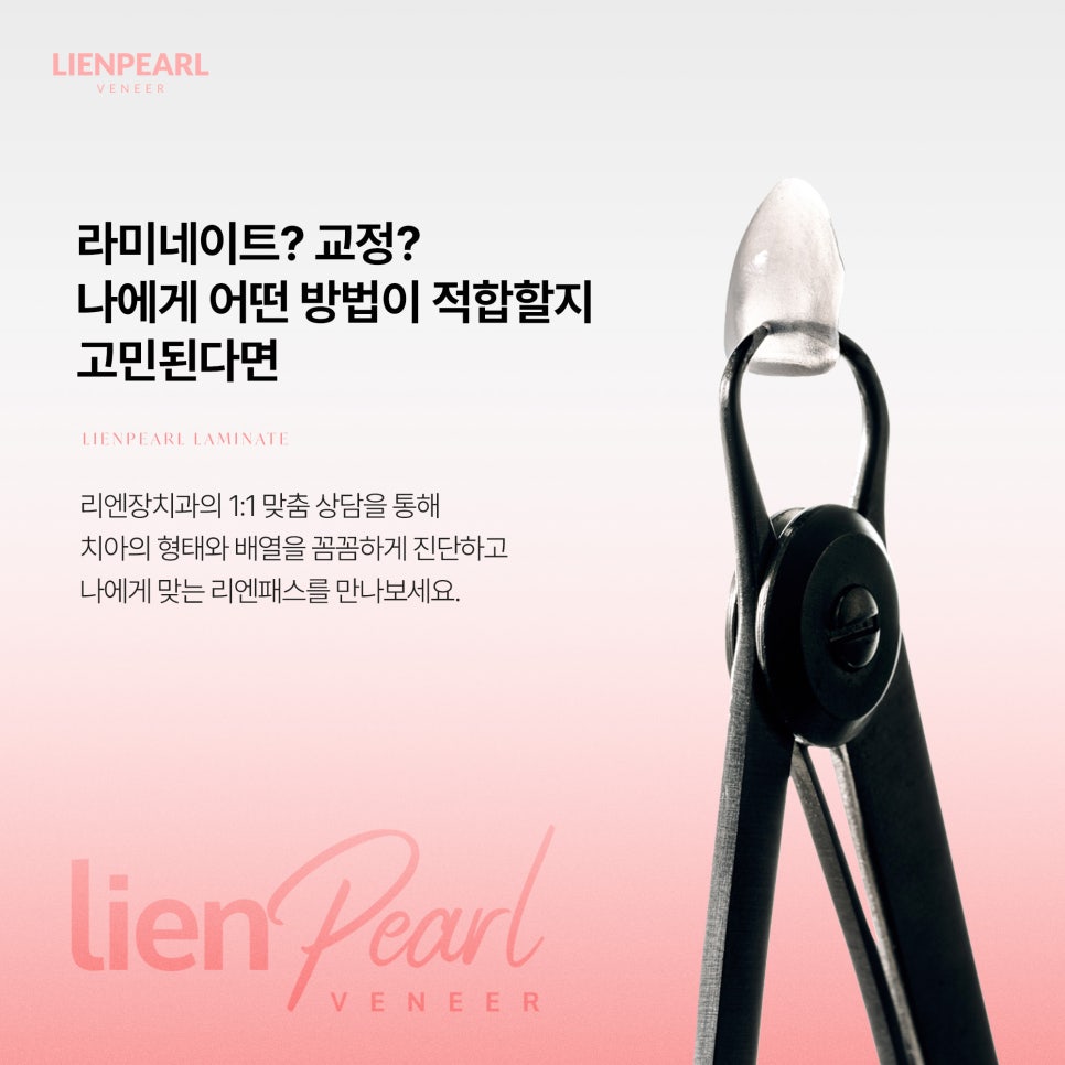 라미네이트 교정 고민될 때, 리엔패스로 살펴봐야 할 것! 관련 이미지 7