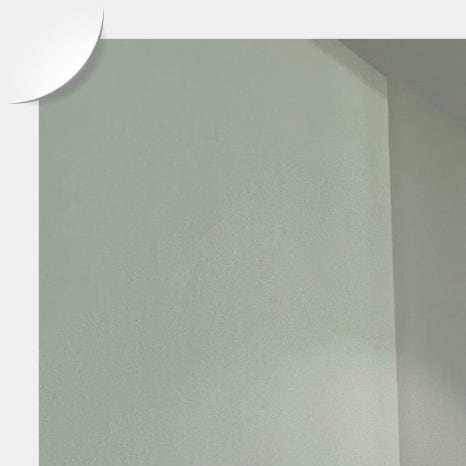 역삼임플란트 식립 과정까지 고려해야 관련 이미지 22