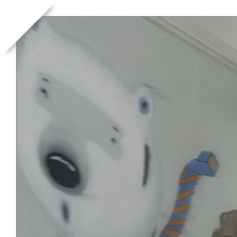 용답동임플란트 뼈 이식까지 고려한다면 관련 이미지 4