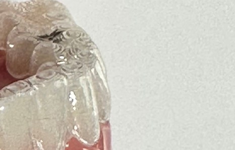 연희임플란트 디지털 네비게이션과 3D 기술로 안전하고 정밀하게 관련 이미지 20