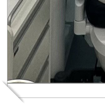 남영동임플란트 비교하기 어려웠다면 관련 이미지 10