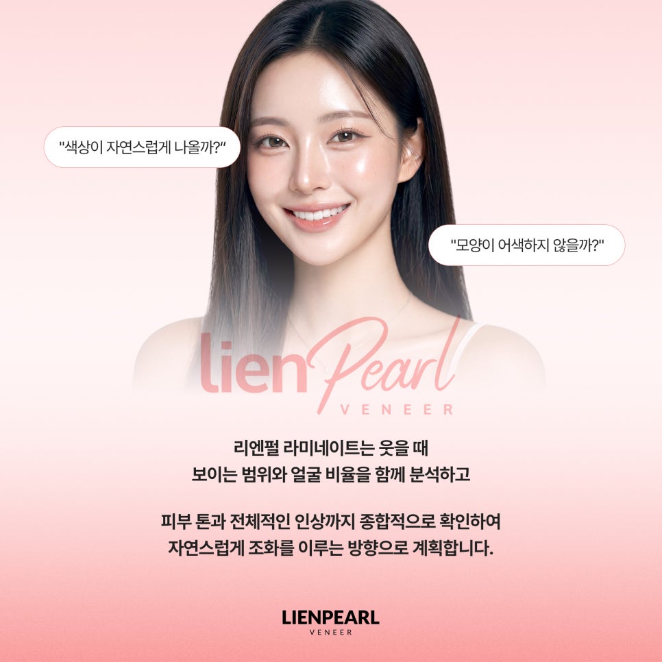 강남역 치아 라미네이트 선택 전 꼭 확인해야 할 기준 관련 이미지 4