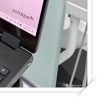 장충동임플란트 주위염 예방하고 건강하게 관련 이미지 12