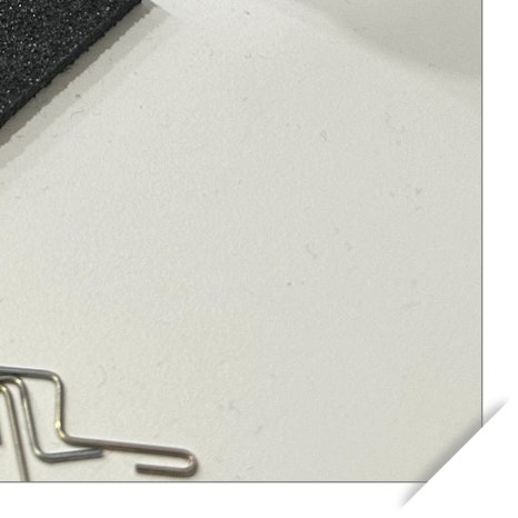 사랑니 수면마취 후기 궁금하다면 관련 이미지 11